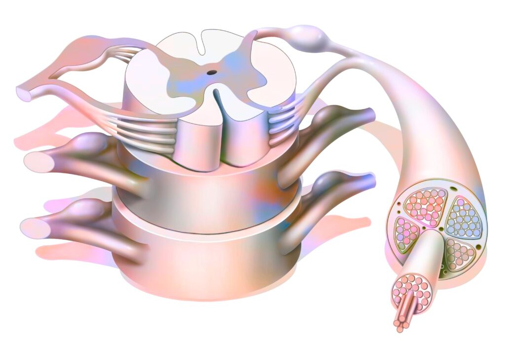 Diagrama anatômico detalhado de um segmento da coluna vertebral e medula espinhal, mostrando um nervo saindo das vértebras. A ilustração é usada para explicar as causas e sintomas de uma hérnia de disco e sua compressão nervosa.
