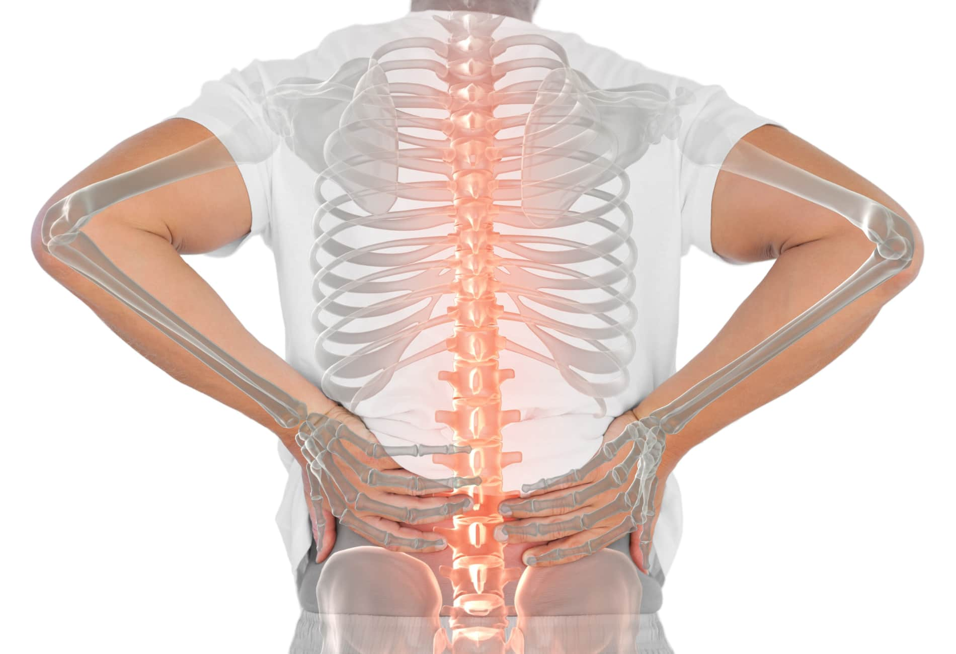 Tudo sobre a sua Coluna Vertebral - ITC Vertebral