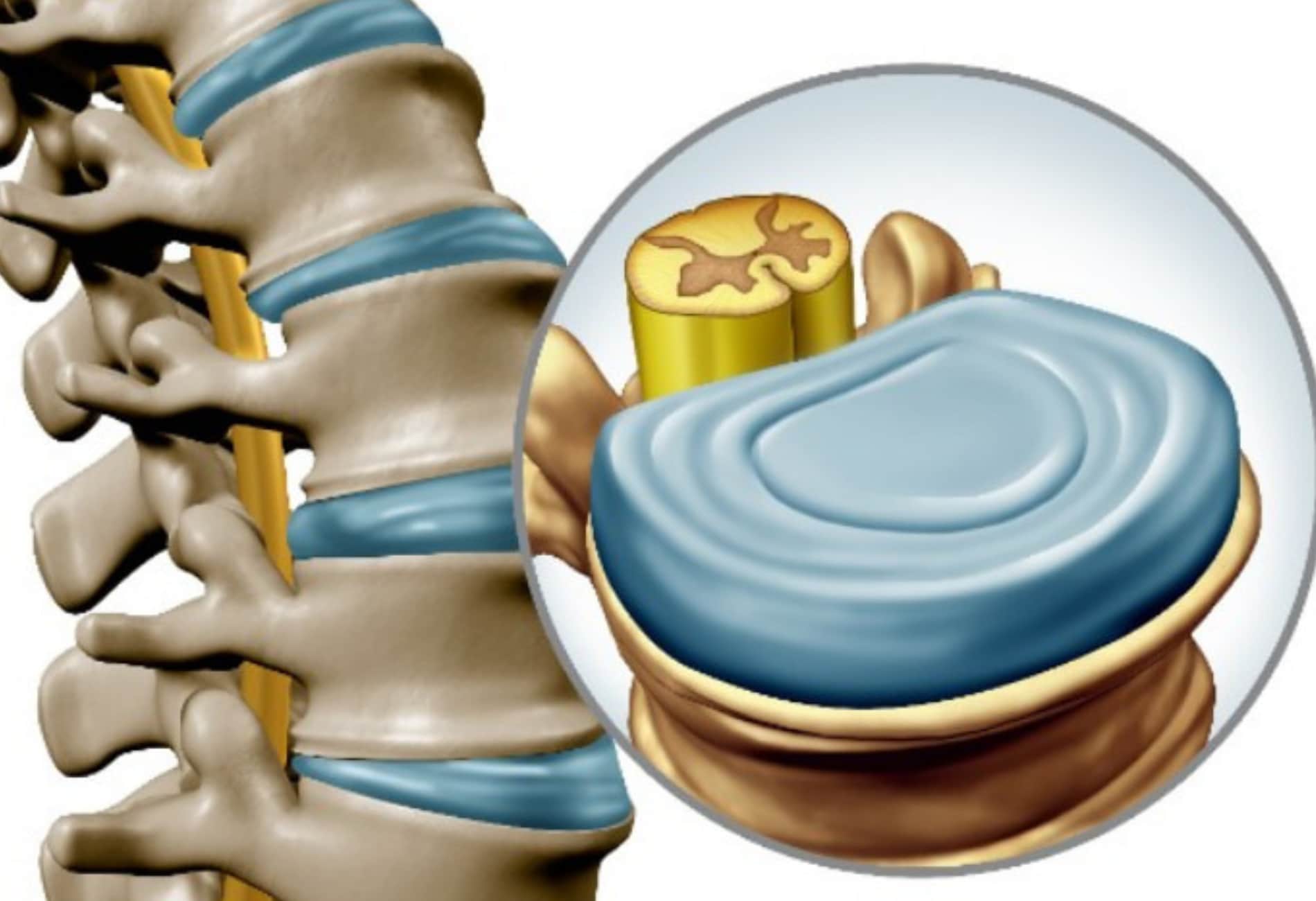 foto de coluna vertebral