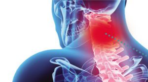 Mielopatia Cervical é ocasionada por lesões que podem ter causas traumáticas ou ser relacionadas com processos infecciosos, inflamatórios; doenças vasculares, neoplásicas ou que envolvam causas nutricionais etc