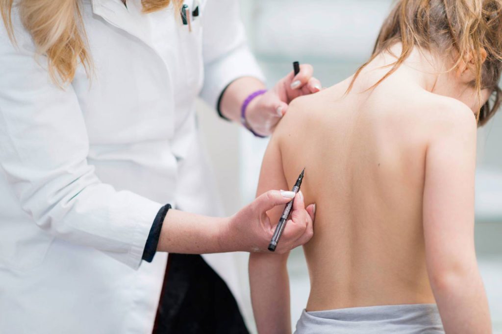 criança fazendo preparação para cirurgia de escoliose