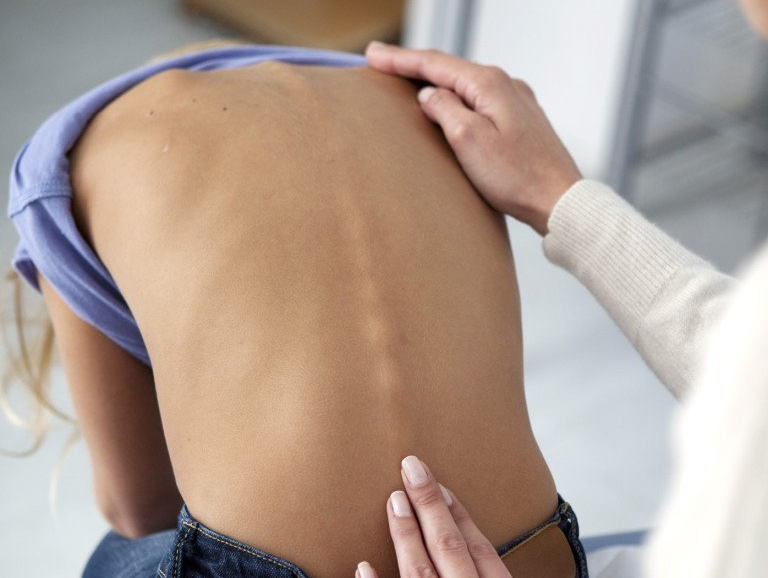 criança fazendo diagnóstico de escoliose em consultório