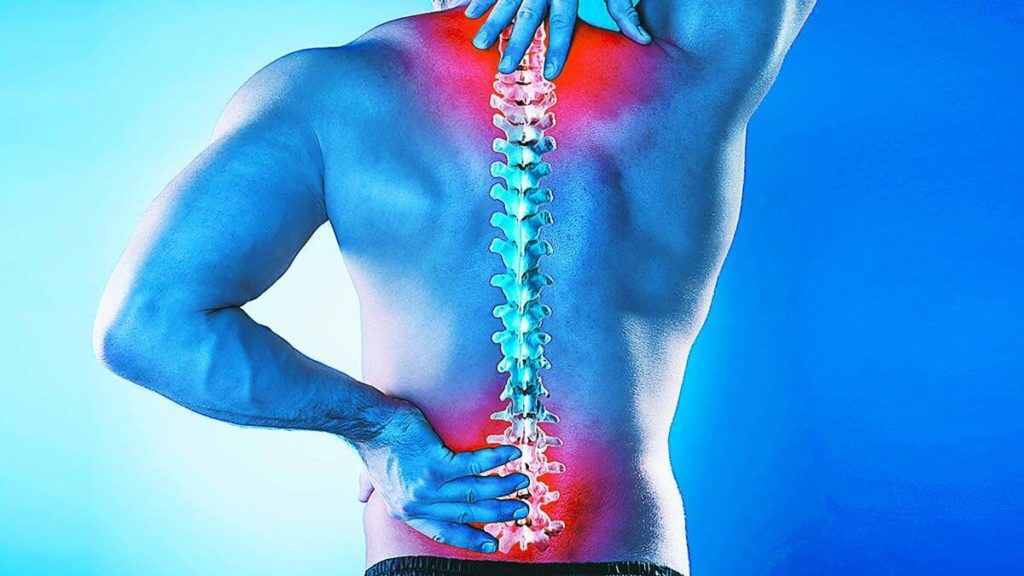 esquema mostranso inflamação na coluna vertebral causada por doenças posturais