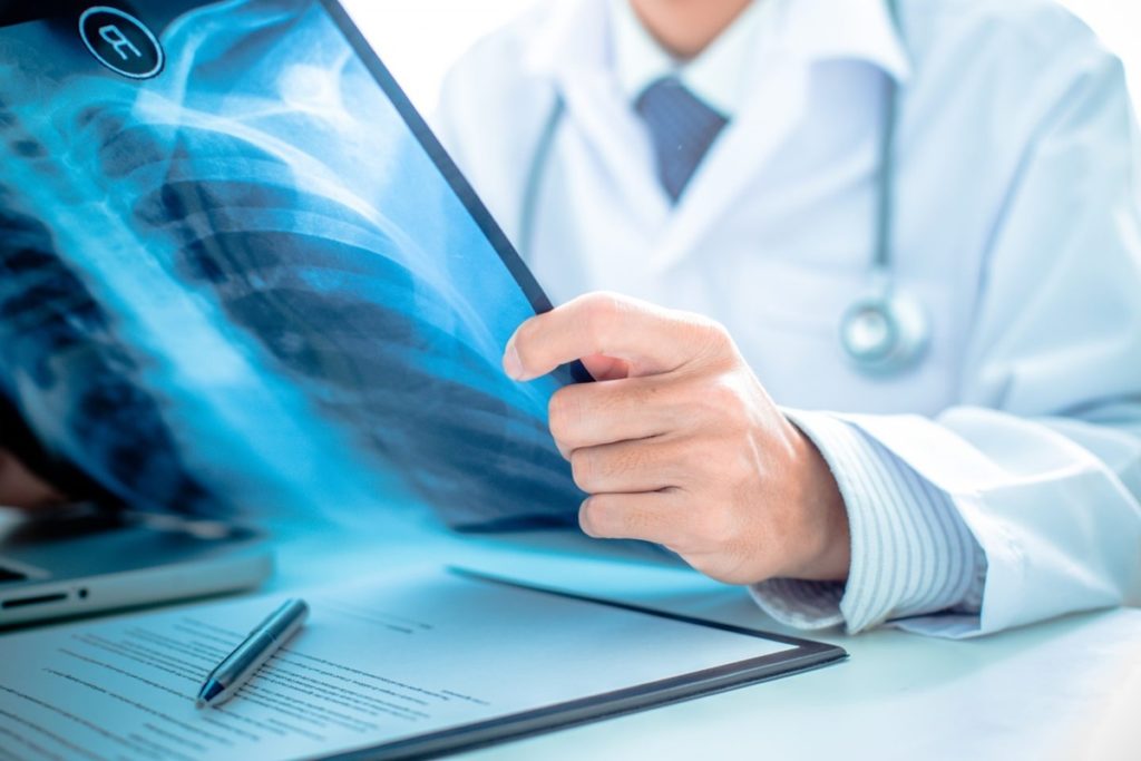 médico analisando radiografia de nódulos de Schmorl