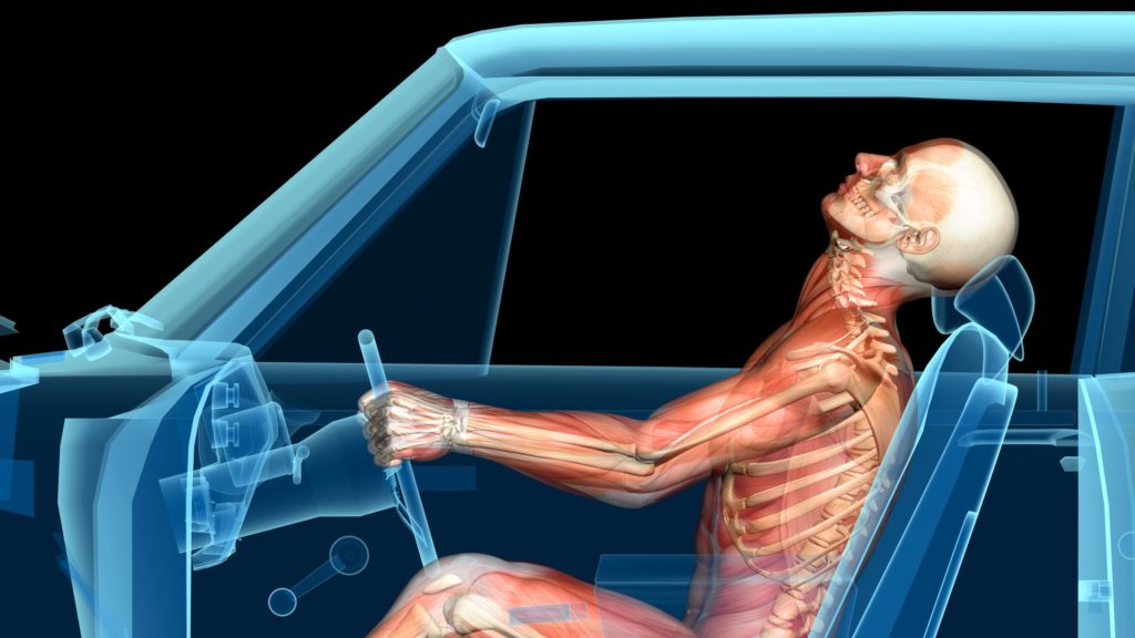 desenho mostrando corpo humano dentro d eum carro sofrendo síndrome do chicote
