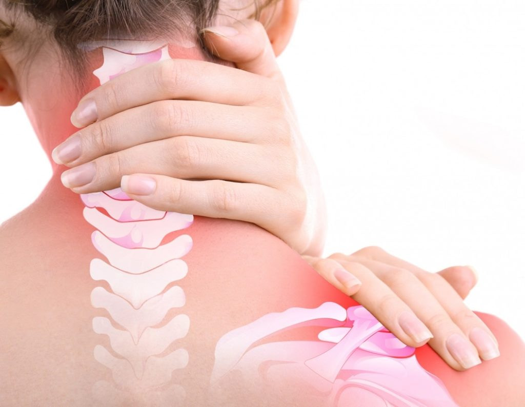 foto de radiculopatia