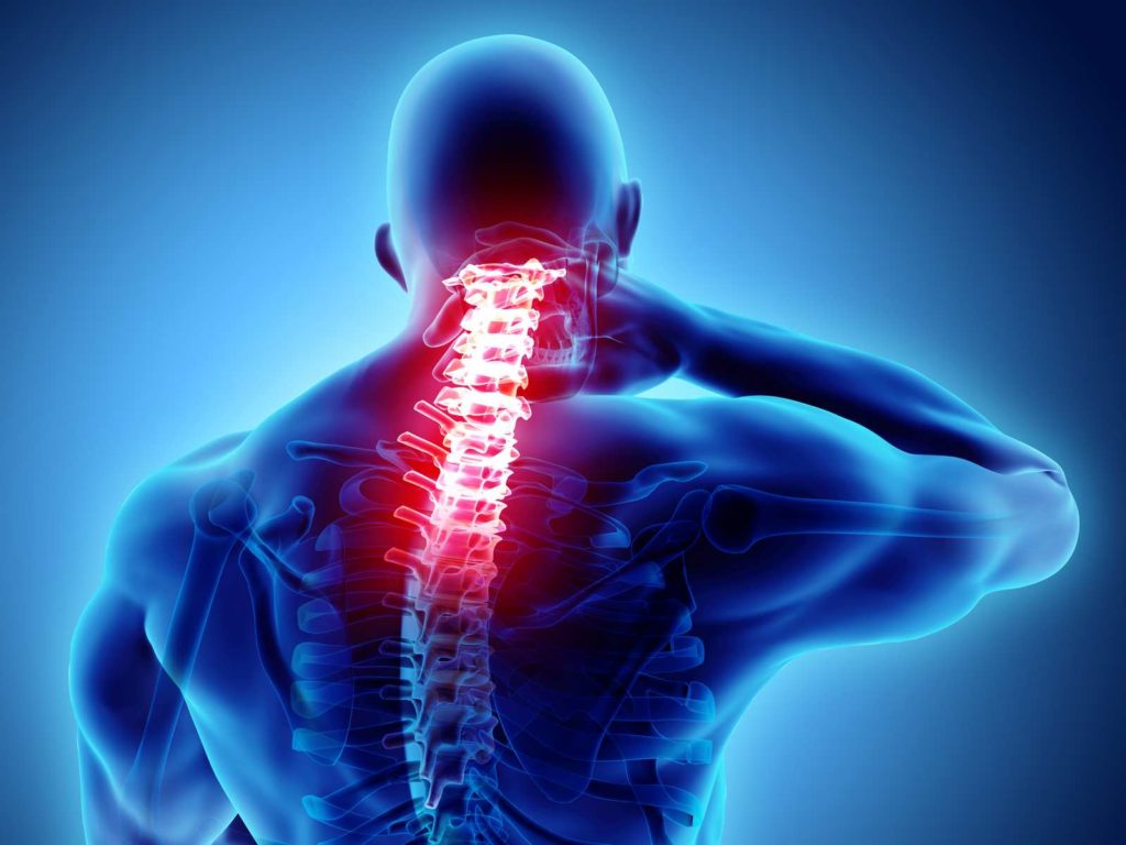 esquema de gráfico mostrando corpo humano com coluna vertebral com retrolistese