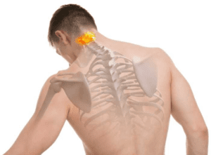 homem com processo odontoide