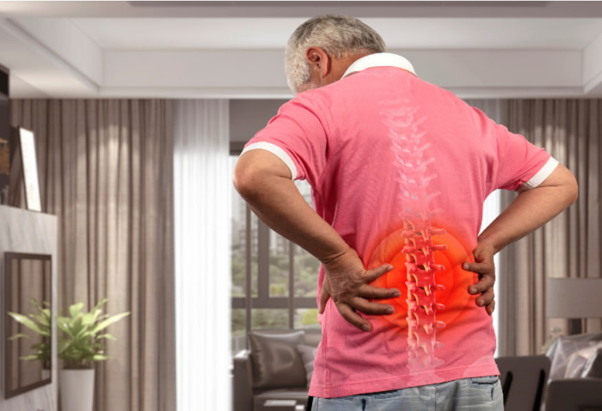 A espondilodiscopatia degenerativa geralmente afeta a região lombar da coluna vertebral. 