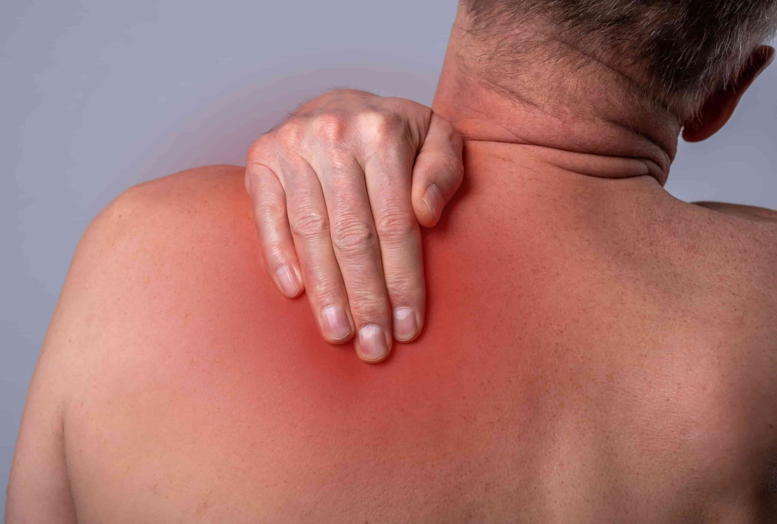 esc-pula-alada-causas-sintomas-tem-cura-itc-vertebral
