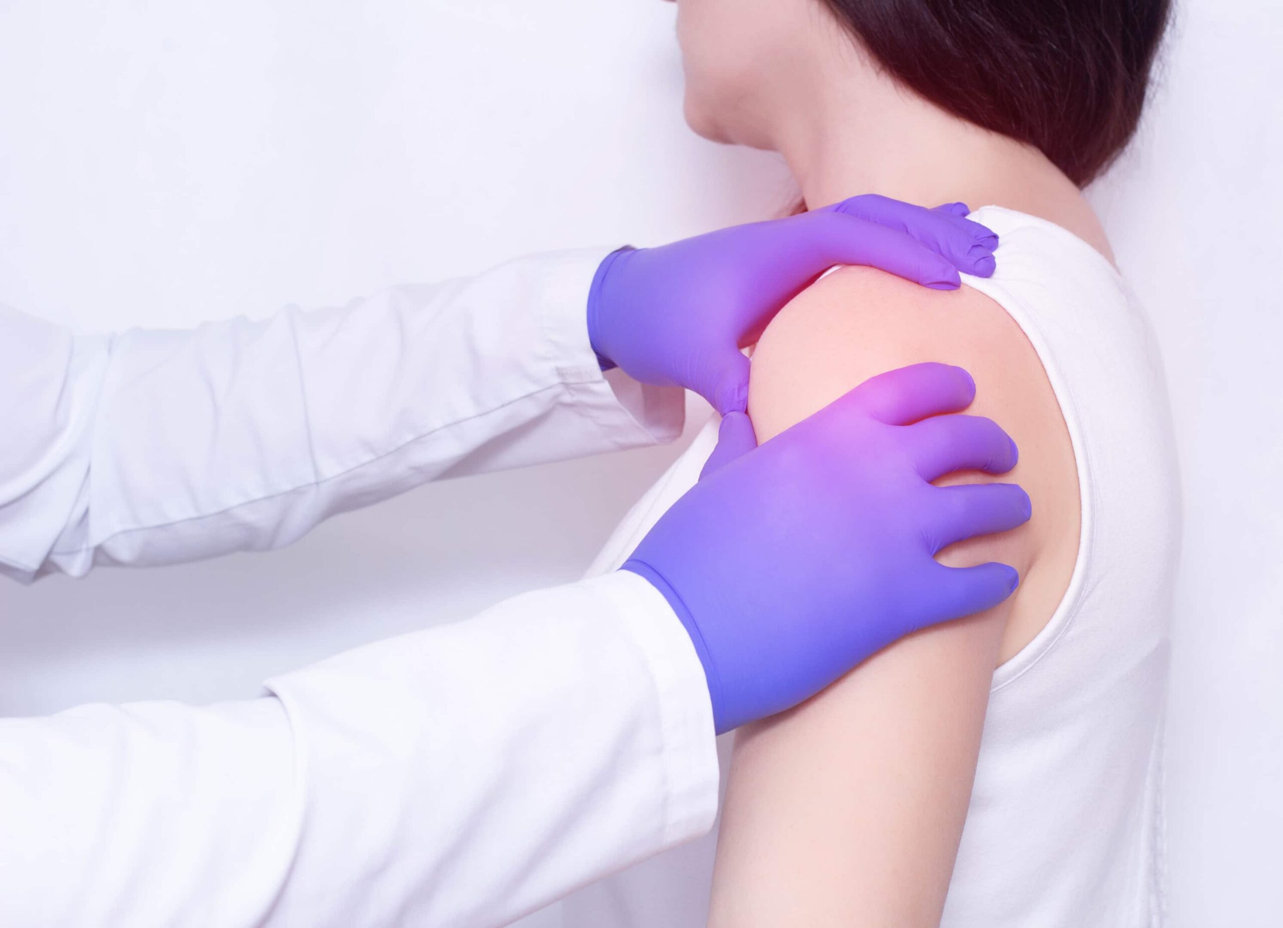 foto de bursite subacromial