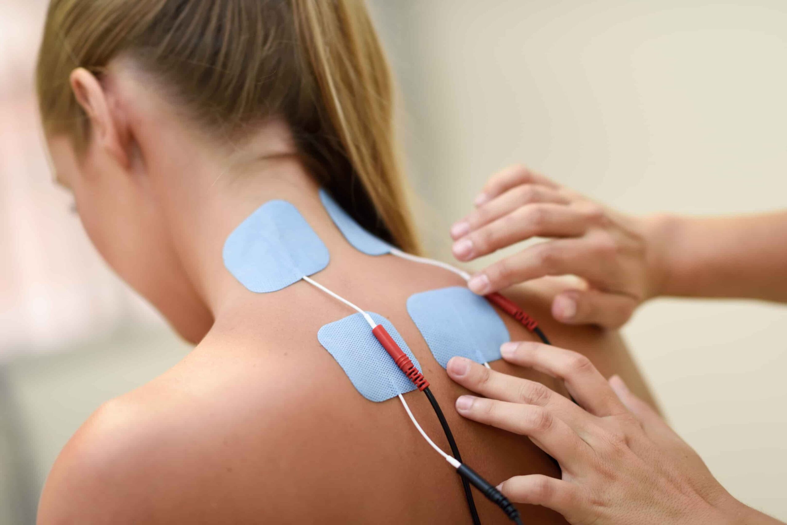 foto de TENS fisioterapia