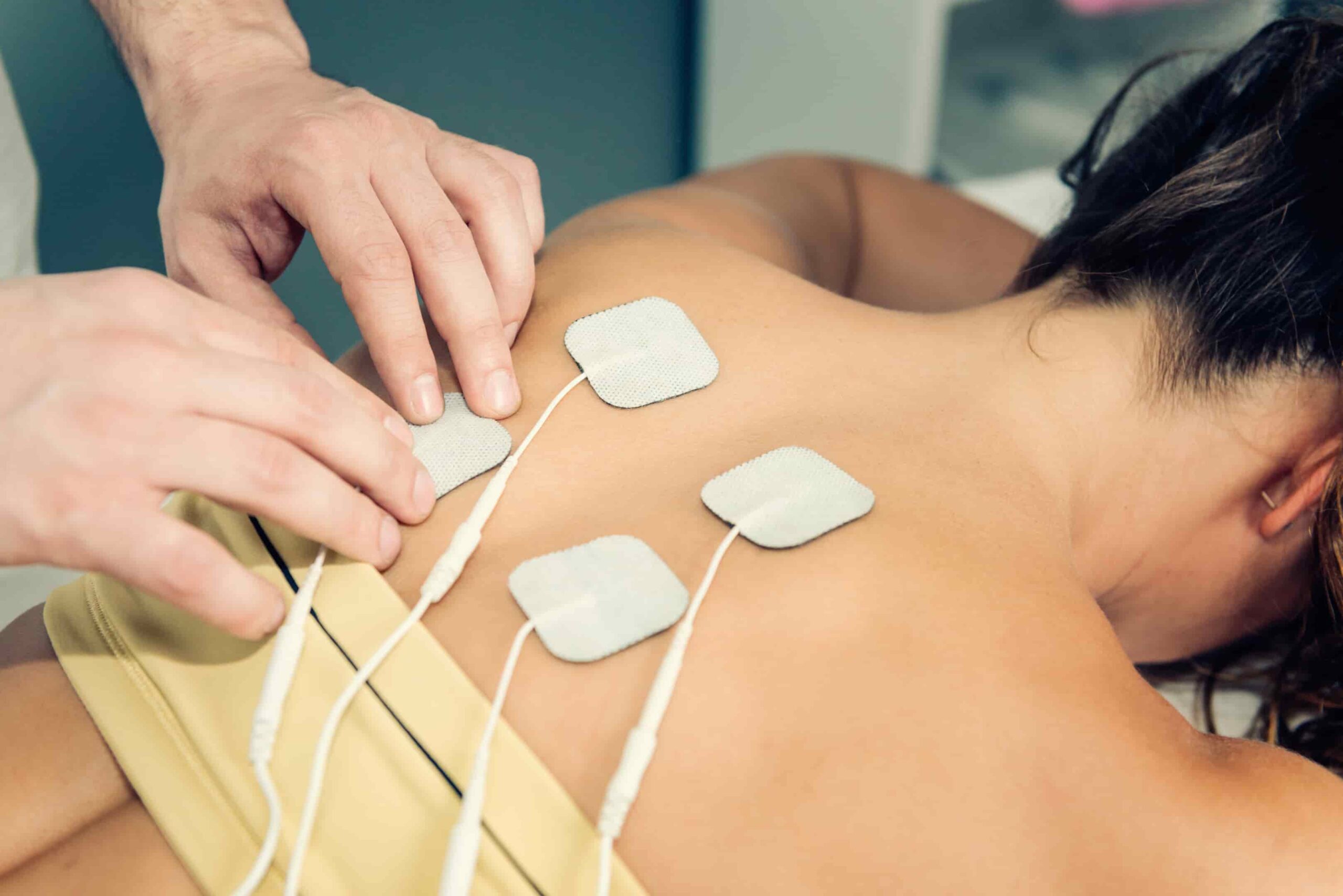 foto de TENS fisioterapia