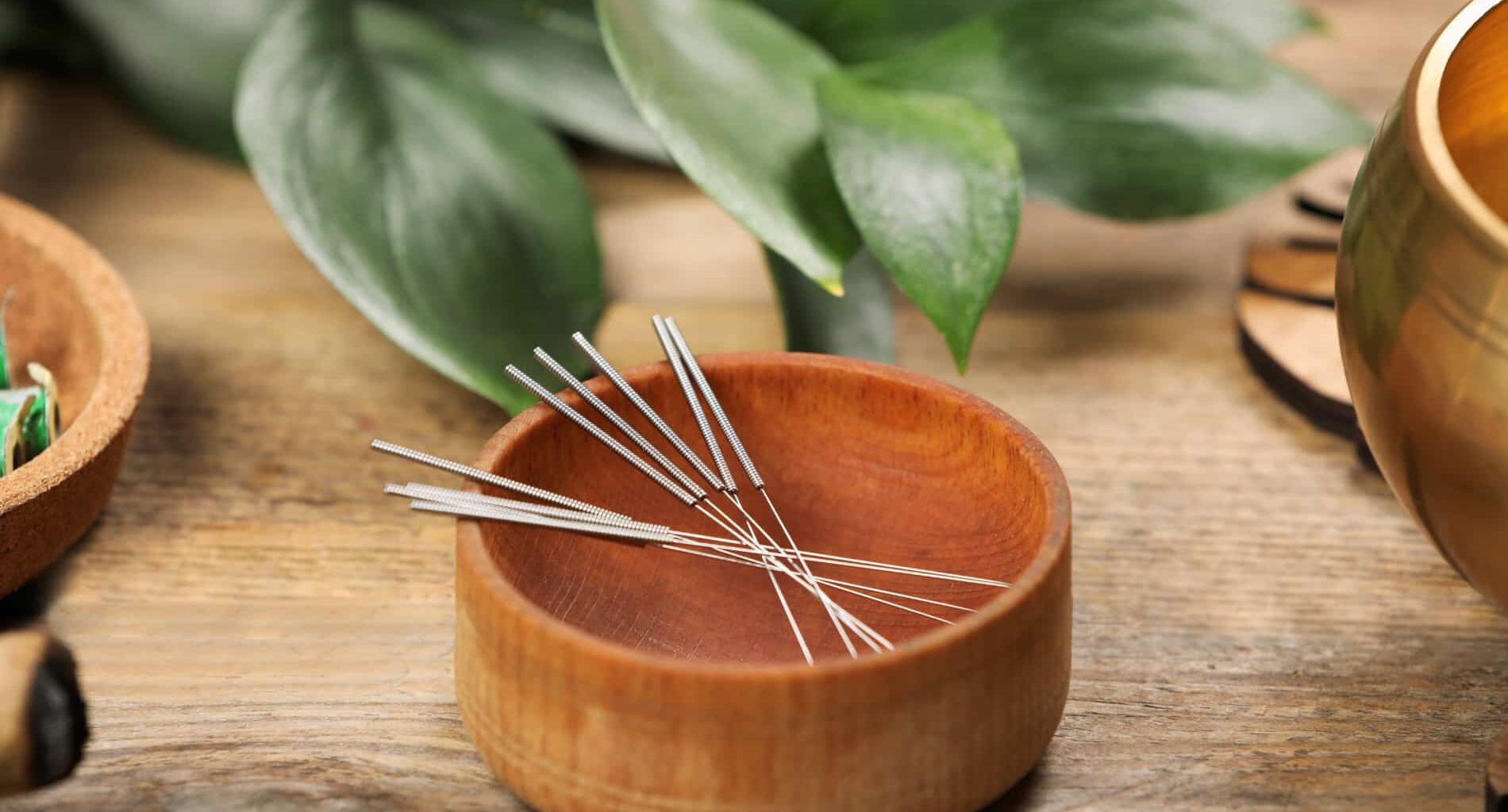foto de acupuntura coluna