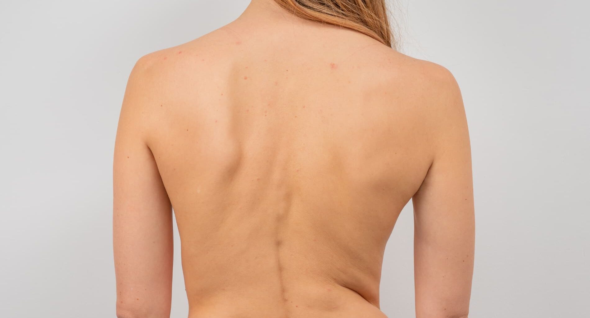 foto de fisioterapia na coluna