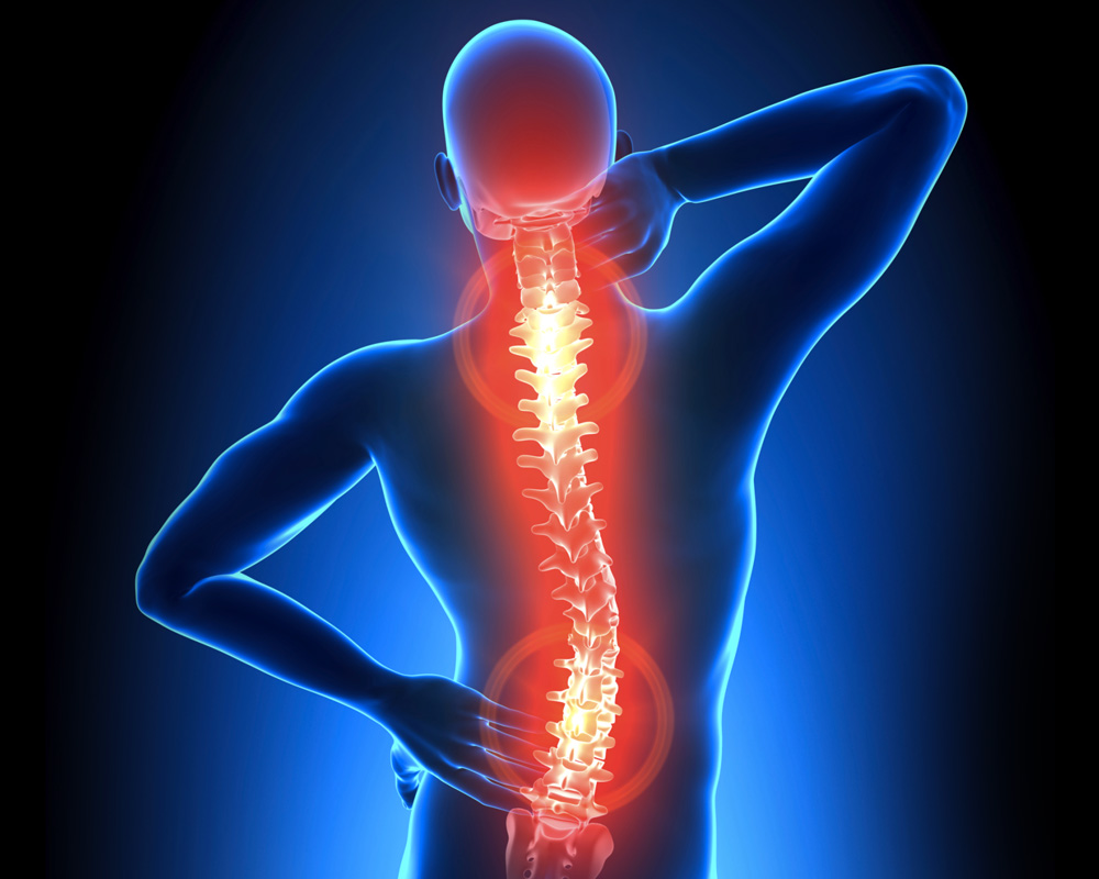 lordose tem cura: coluna vertebral